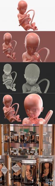 3D Human Fetus at 20 Weeks